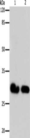 Gel: 10%SDS-PAGE, Lysate: 24 μg, Lane 1-2: 293T cells, Hela cells, Primary antibody: GJB6 Antibody(GJB6 Antibody) at dilution 1/600, Secondary antibody: Goat anti rabbit IgG at 1/8000 dilution, Exposure time: 2 minutesRabbit anti-Human GJB6 Polyclonal Antibody
