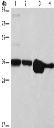 Gel: 10%SDS-PAGE, Lysate: 40 μg, Lane 1-4: Hela cells, NIH/3T3 cells, A172 cells, A431 cells, Primary antibody: ELAVL1 Antibody(ELAVL1 Antibody) at dilution 1/800, Secondary antibody: Goat anti rabbit IgG at 1/8000 dilution, Exposure time: 5 secondsRabbit anti-Human ELAVL1 Polyclonal Antibody