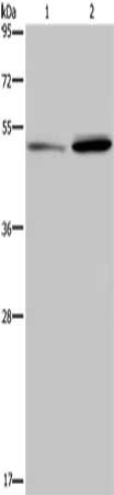 Gel: 8%SDS-PAGE, Lysate: 40 μg, Lane 1-2: Mouse brain tissue, 823 cells, Primary antibody: MMP20 Antibody(MMP20 Antibody) at dilution 1/250, Secondary antibody: Goat anti rabbit IgG at 1/8000 dilution, Exposure time: 20 secondsRabbit anti-Human MMP20 Polyclonal Antibody