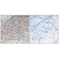 Immunohistochemistry analysis of paraffin-embedded human testis tissue using MAST4 antibody.