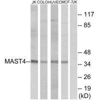 Western blot analysis of extracts from Jurkat cells, COLO cells, HUVEC cells and MCF-7 cells, using MAST4 antibody.