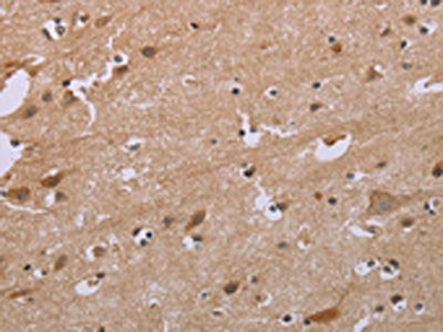 The image on the left is immunohistochemistry of paraffin-embedded Human brain  tissue using ACVR2A Antibody(ACVR2A Antibody) at dilution 1/20, on the right is treated with synthetic peptide. (Original magnification: ×200)Rabbit anti-Human ACVR2A Polyclonal Antibody