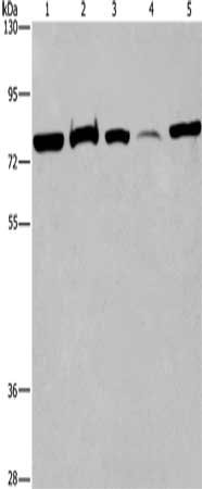 Gel: 6%SDS-PAGE, Lysate: 40 μg, Lane 1-5: 293T cells, human fetal brain tissue, K562 cells, human fetal liver tissue, Hela cells, Primary antibody: ACVR2A Antibody(ACVR2A Antibody) at dilution 1/400, Secondary antibody: Goat anti rabbit IgG at 1/8000 dilution, Exposure time: 40 secondsRabbit anti-Human ACVR2A Polyclonal Antibody