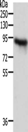 Gel: 10%SDS-PAGE, Lysate: 40 μg, Lane: Mouse heart tissue, Primary antibody: ACO2 Antibody(ACO2 Antibody) at dilution 1/500, Secondary antibody: Goat anti rabbit IgG at 1/8000 dilution, Exposure time: 5 seconds
