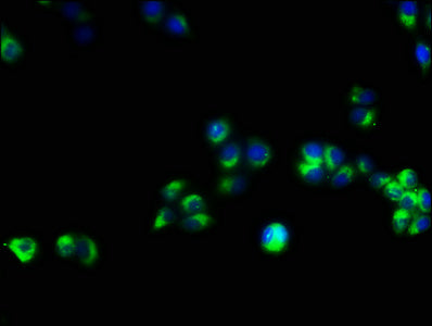 Immunofluorescence staining of PC-3 cells with CD3E Antibody at 1:53, counter-stained with DAPI. The cells were fixed in 4% formaldehyde, permeabilized using 0.2% Triton X-100 and blocked in 10% normal Goat Serum. The cells were then incubated with the antibody overnight at 4°C. The secondary antibody was Alexa Fluor 488-congugated AffiniPure Goat Anti-Rabbit IgG(H+L).Rabbit anti-Human CD3E Polyclonal Antibody