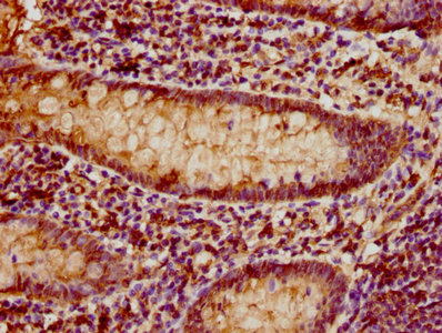 IHC image of the antibody diluted at 1:80 and staining in paraffin-embedded human appendix tissue performed on a Leica BondTM system. After dewaxing and hydration, antigen retrieval was mediated by high pressure in a citrate buffer (pH 6.0). Section was blocked with 10% normal goat serum 30min at RT. Then primary antibody (1% BSA) was incubated at 4°C overnight. The primary is detected by a biotinylated secondary antibody and visualized using an HRP conjugated SP system.Rabbit anti-Human CD3E Polyclonal Antibody