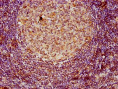 IHC image of CD3E Antibody diluted at 1:80 and staining in paraffin-embedded human lymph node tissue performed on a Leica BondTM system. After dewaxing and hydration, antigen retrieval was mediated by high pressure in a citrate buffer (pH 6.0). Section was blocked with 10% normal goat serum 30min at RT. Then primary antibody (1% BSA) was incubated at 4°C overnight. The primary is detected by a biotinylated secondary antibody and visualized using an HRP conjugated SP system.Rabbit anti-Human CD3E Polyclonal Antibody