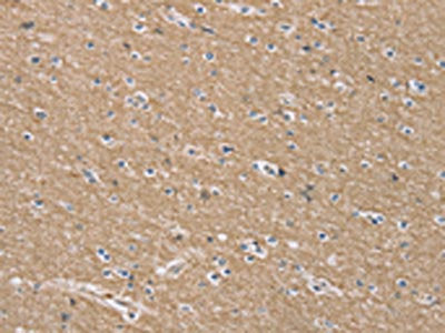 The image on the left is immunohistochemistry of paraffin-embedded Human brain  tissue using TFRC Antibody(TFRC Antibody) at dilution 1/35, on the right is treated with synthetic peptide. (Original magnification: ×200)Rabbit anti-Human TFRC Polyclonal Antibody