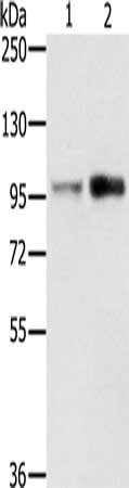 Gel: 6%SDS-PAGE, Lysate: 40 μg, Lane 1-2: 231 cells, Jurkat cells, Primary antibody: TFRC Antibody(TFRC Antibody) at dilution 1/200, Secondary antibody: Goat anti rabbit IgG at 1/8000 dilution, Exposure time: 20 secondsRabbit anti-Human TFRC Polyclonal Antibody