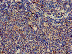 Immunohistochemistry of paraffin-embedded human lymph node tissue using CD247 Antibody at dilution of 1:100Rabbit anti-Human CD247 Polyclonal Antibody