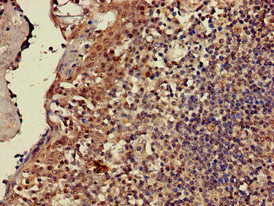 Immunohistochemistry of paraffin-embedded human tonsil tissue using CD247 Antibody at dilution of 1:100Rabbit anti-Human CD247 Polyclonal Antibody