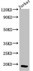 Western Blot  | Positive WB detected in: Jurkat whole cell lysate  | All lanes: CD247 antibody at 3µg/ml  | Secondary  | Goat polyclonal to rabbit IgG at 1/50000 dilution  | Predicted band size: 19 kDa  | Observed band size: 19 kDaRabbit anti-Human CD247 Polyclonal Antibody