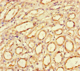 Immunohistochemistry of paraffin-embedded human kidney tissue using CD34 Antibody at dilution of 1:100Rabbit anti-Human CD34 Polyclonal Antibody