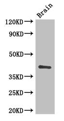 Western Blot | Positive WB detected in: Mouse brain tissue | All lanes: CD34 antibody at 3μg/ml | Secondary | Goat polyclonal to rabbit IgG at 1/50000 dilution | Predicted band size: 41, 36 kDa | Observed band size: 41 kDaRabbit anti-Human CD34 Polyclonal Antibody
