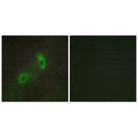 Immunofluorescence analysis of HUVEC cells, using HGS antibody.Rabbit anti-Human HGS Polyclonal Antibody