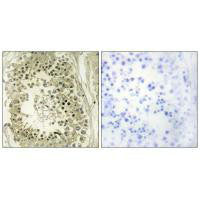 Immunohistochemistry analysis of paraffin-embedded human testis tissue using HGS antibody.Rabbit anti-Human HGS Polyclonal Antibody