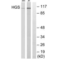 Western blot analysis of extracts from 293 cells and JK cells, using HGS antibody.Rabbit anti-Human HGS Polyclonal Antibody