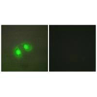 Immunofluorescence analysis of A549 cells, using TOP2A antibody.Rabbit anti-Human TOP2A Polyclonal Antibody