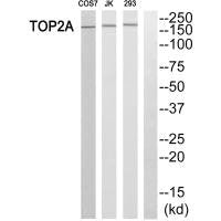 Western blot analysis of extracts from HT-29 cells, using TOP2A antibody.Rabbit anti-Human TOP2A Polyclonal Antibody