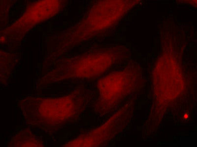 Immunofluorescence staining of methanol-fixed Hela cells using Histone H2A.X(Phospho-Ser139) Antibody.Rabbit anti-Human H2AFX Polyclonal Antibody