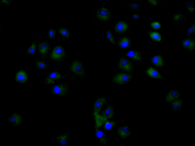 Immunofluorescent analysis of Hela cells using CD9 Antibody at dilution of 1:100 and Alexa Fluor 488-congugated AffiniPure Goat Anti-Rabbit IgG(H+L)Rabbit anti-Human CD9 Polyclonal Antibody
