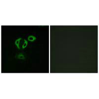 Immunofluorescence analysis of A549cells, using TACC3 antibody.
