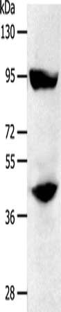 Gel: 10%SDS-PAGE, Lysate: 50 μg, Lane: SKOV3 cells, Primary antibody: STAT5B Antibody(STAT5B Antibody) at dilution 1/200, Secondary antibody: Goat anti rabbit IgG at 1/8000 dilution, Exposure time: 1 minuteRabbit anti-Human STAT5B Polyclonal Antibody