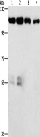 Gel: 6%SDS-PAGE, Lysate: 40 μg, Lane 1-4: Hela cells, hepG2 cells, lovo cells, human colon cancer tissue, Primary antibody: CDK11A/CDK11B Antibody(CDK11A/CDK11B Antibody) at dilution 1/750, Secondary antibody: Goat anti rabbit IgG at 1/8000 dilution, Exposure time: 1 minuteRabbit anti-Human CDK11A/CDK11B Polyclonal Antibody