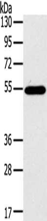 Gel: 8%SDS-PAGE, Lysate: 40 μg, Lane: Mouse thymus tissue, Primary antibody: CFLAR Antibody(CFLAR Antibody) at dilution 1/200, Secondary antibody: Goat anti rabbit IgG at 1/8000 dilution, Exposure time: 1 minuteRabbit anti-Human CFLAR Polyclonal Antibody