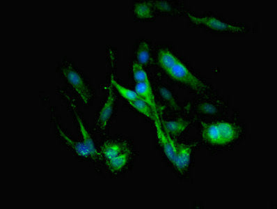 Immunofluorescent analysis of Hela cells using C3 Antibody at dilution of 1:100 and Alexa Fluor 488-congugated AffiniPure Goat Anti-Rabbit IgG(H+L)
