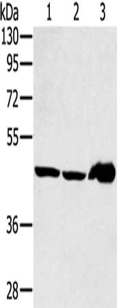 Gel: 8%SDS-PAGE, Lysate: 40 μg, Lane 1-3: Mouse liver tissue, PC3 cells, human fetal liver tissue, Primary antibody: SEC14L2 Antibody(SEC14L2 Antibody) at dilution 1/400, Secondary antibody: Goat anti rabbit IgG at 1/8000 dilution, Exposure time: 2 minutesRabbit anti-Human SEC14L2 Polyclonal Antibody