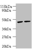 Western blot  | All lanes: KRT18 antibody at 2µg/ml  | Lane 1: K562 whole cell lysate  | Lane 2: HepG2 whole cell lysate  | Secondary  | Goat polyclonal to rabbit IgG at 1/10000 dilution  | Predicted band size: 49 kDa  | Observed band size: 49 kDa