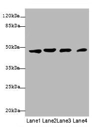 Western blot  | All lanes: KRT18 antibody at 12µg/ml  | Lane 1: A431 whole cell lysate  | Lane 2: Hela whole cell lysate  | Lane 3: Jurkat whole cell lysate  | Lane 4: Zebrafish lysate  | Secondary  | Goat polyclonal to rabbit IgG at 1/10000 dilution  | Predicted band size: 49 kDa  | Observed band size: 49 kDa
