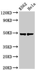 Western Blot  | Positive WB detected in: K562 whole cell lysate, Hela whole cell lysate  | All lanes: KRT18 antibody at 3µg/ml  | Secondary  | Goat polyclonal to rabbit IgG at 1/50000 dilution  | Predicted band size: 49 kDa  | Observed band size: 49 kDa