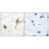 Immunohistochemical analysis of paraffin-embedded human brain tissue using GABA B Receptor antibody.Rabbit anti-Human GABBR1 Polyclonal Antibody