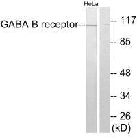 Western blot analysis of extracts from HeLa cells, using GABA B Receptor antibody.Rabbit anti-Human GABBR1 Polyclonal Antibody