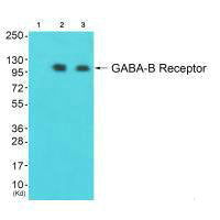 Western blot analysis of extracts from JK cells (Lane 2) and A549 cells (Lane 3), using GABA-B Receptor antiobdy. The lane on the left is treated with synthesized peptide.Rabbit anti-Human GABBR1 Polyclonal Antibody