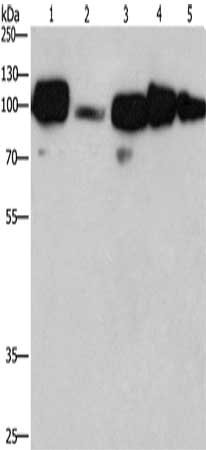 Gel: 8%SDS-PAGE, Lysate: 40 μg, Lane 1-5: Hela cells, mouse liver tissue, 231 cells, human placenta tissue, human carcinoma of sigmoid tissue, Primary antibody: CANX Antibody(CANX Antibody) at dilution 1/420, Secondary antibody: Goat anti rabbit IgG at 1/8000 dilution, Exposure time: 20 seconds