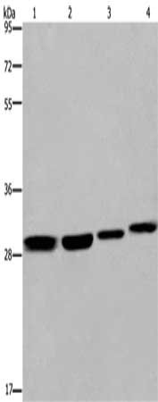 Gel: 8%SDS-PAGE, Lysate: 40 μg, Lane 1-4: 293T cells, LoVo cells, mouse skin tissue, A172 cells, Primary antibody: ETV7 Antibody(ETV7 Antibody) at dilution 1/600, Secondary antibody: Goat anti rabbit IgG at 1/8000 dilution, Exposure time: 30 secondsRabbit anti-Human ETV7 Polyclonal Antibody