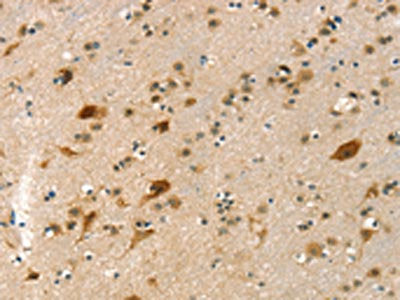 The image on the left is immunohistochemistry of paraffin-embedded Human brain  tissue using GNB2L1 Antibody(GNB2L1 Antibody) at dilution 1/20, on the right is treated with fusion protein. (Original magnification: ×200)Rabbit anti-Human GNB2L1 Polyclonal Antibody