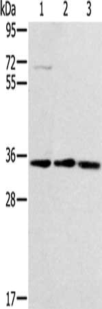 Gel: 8%SDS-PAGE, Lysate: 40 μg, Lane 1-3: Hepg2 cells, NIH/3T3 cells, Jurkat cells, Primary antibody: GNB2L1 Antibody(GNB2L1 Antibody) at dilution 1/300, Secondary antibody: Goat anti rabbit IgG at 1/8000 dilution, Exposure time: 1 minuteRabbit anti-Human GNB2L1 Polyclonal Antibody