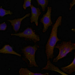 Immunofluorescence staining of methanol-fixed Hela cells using p62Dok(Ab-398) Antibody.Rabbit anti-Human DOK1 Polyclonal Antibody