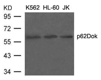 Western blot analysis of extracts from K562, HL-60 and JK cells using p62Dok(Ab-398) Antibody.Rabbit anti-Human DOK1 Polyclonal Antibody