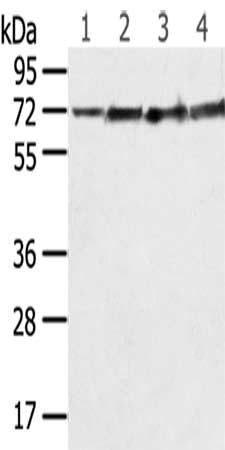 Gel: 8%SDS-PAGE,Lysate: 40 μg,Lane 1-4: Mouse brain tissue, Hela cells, Jurkat cells, Mouse heart tissue,Primary antibody: SDHA Antibody(SDHA Antibody) at dilution 1/600 dilution,Secondary antibody: Goat anti rabbit IgG at 1/8000 dilution,Exposure time: 5 secondsRabbit anti-Human SDHA Polyclonal Antibody