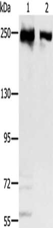 Gel: 6%SDS-PAGE, Lysate: 40 μg, Lane 1-2: Hela cells, 293T cells, Primary antibody: MCM3AP Antibody(MCM3AP Antibody) at dilution 1/350, Secondary antibody: Goat anti rabbit IgG at 1/8000 dilution, Exposure time: 20 seconds
