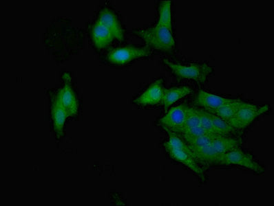Immunofluorescent analysis of Hela cells using RARRES2 Antibody at dilution of 1:100 and Alexa Fluor 488-congugated AffiniPure Goat Anti-Rabbit IgG(H+L)Rabbit anti-Human RARRES2 Polyclonal Antibody