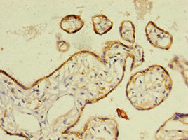 Immunohistochemistry of paraffin-embedded human placenta tissue using the antibody at dilution of 1:100Rabbit anti-Human RARRES2 Polyclonal Antibody