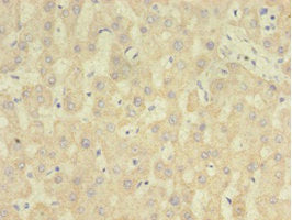 Immunohistochemistry of paraffin-embedded human liver tissue using RARRES2 Antibody at dilution of 1:100Rabbit anti-Human RARRES2 Polyclonal Antibody