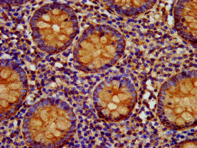 IHC image of EPCAM Antibody diluted at 1:400 and staining in paraffin-embedded human appendix tissue performed on a Leica BondTM system. After dewaxing and hydration, antigen retrieval was mediated by high pressure in a citrate buffer (pH 6.0). Section was blocked with 10% normal goat serum 30min at RT. Then primary antibody (1% BSA) was incubated at 4°C overnight. The primary is detected by a biotinylated secondary antibody and visualized using an HRP conjugated SP system.Rabbit anti-Human EPCAM Polyclonal Antibody