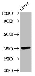 Western Blot | Positive WB detected in: Rat liver tissue | All lanes: EPCAM antibody at 9.6μg/ml | Secondary | Goat polyclonal to rabbit IgG at 1/50000 dilution | Predicted band size: 35 kDa | Observed band size: 35 kDaRabbit anti-Human EPCAM Polyclonal Antibody